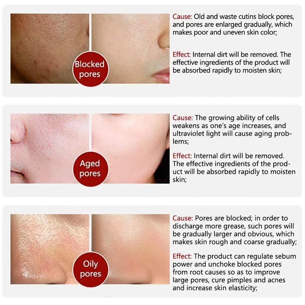Skin Texture | Pore Refining Resurfacing, Brightening Facial Serum