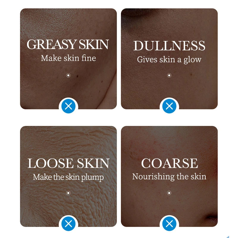 5pcs SADOER Ice Masks for Face Deep Hydrating Moisturizing