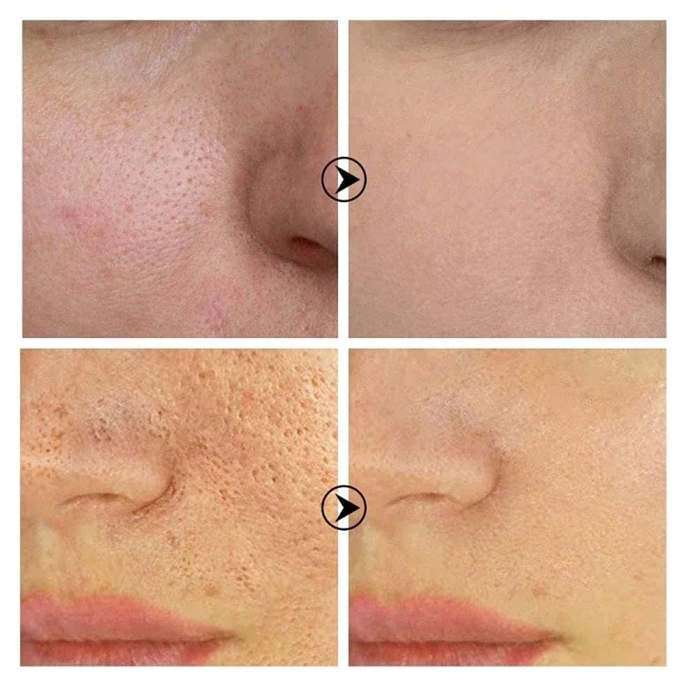 Skin Texture | Pore Refining Resurfacing, Brightening Facial Serum