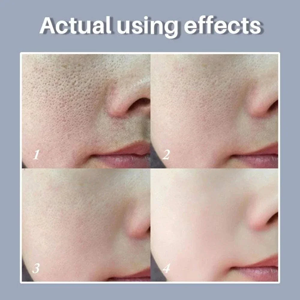 Skin Texture | Pore Refining Resurfacing, Brightening Facial Serum